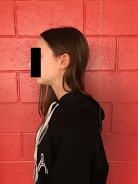 Posture adolescente après correction