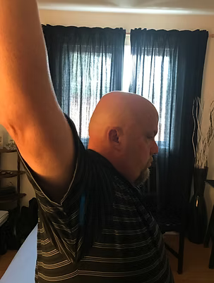 Flexion épaule après traitement