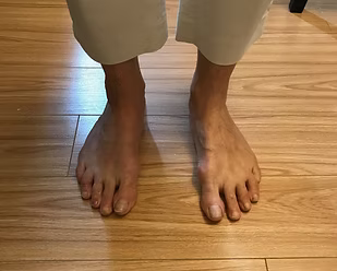 Pied droit aligné après intervention